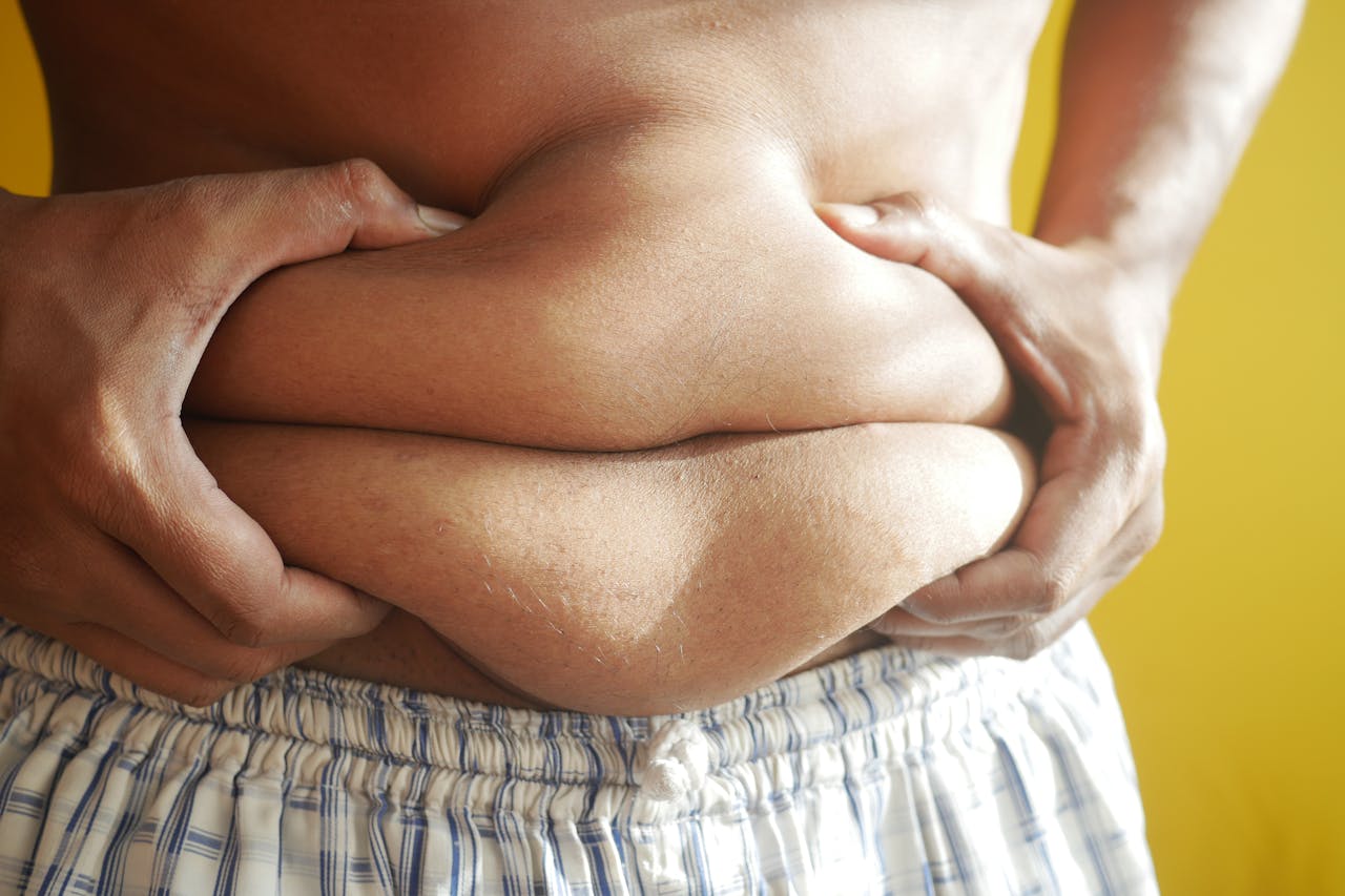 patologías relacionadas con la obesidad